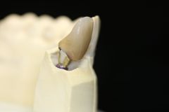 B68