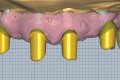 Ab.-fertig-frontal-3