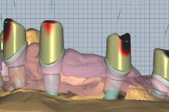 Ab.-fertig-frontal-9