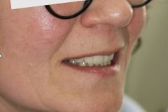 IMG_5556